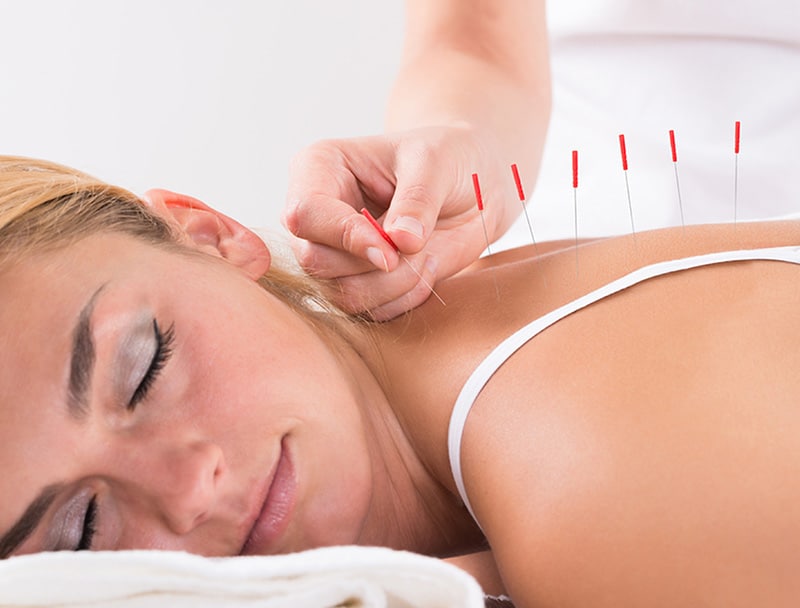 acupuncture in north york