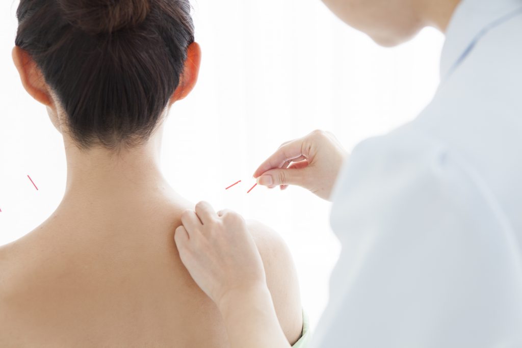 can acupuncture help a stiff and sore neck